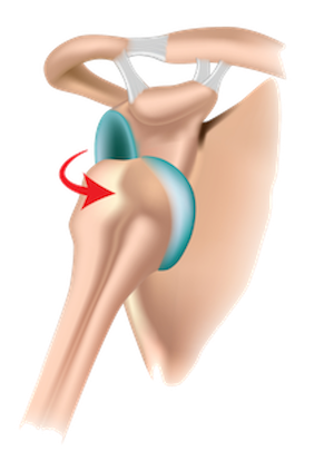 Physiotherapy anterior stabilisation leaflet